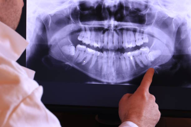 Best Chipped Tooth Repair Near Me  in Westfield, PA